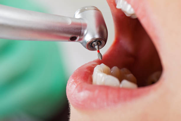 Best Knocked-Out Tooth Emergency  in Payson, AZ